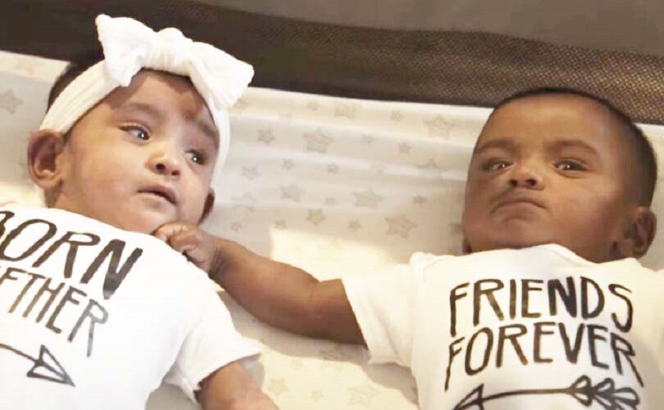 ‘0% de probabilidad de supervivencia’: gemelos prematuros más jóvenes del mundo celebran su primer cumpleaños